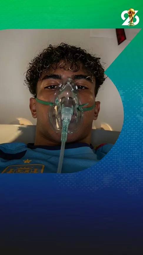 قبل كأس العالم.. قناع لامين يامال يثير القلق